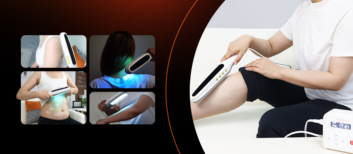 Handheld UVB therapy on leg