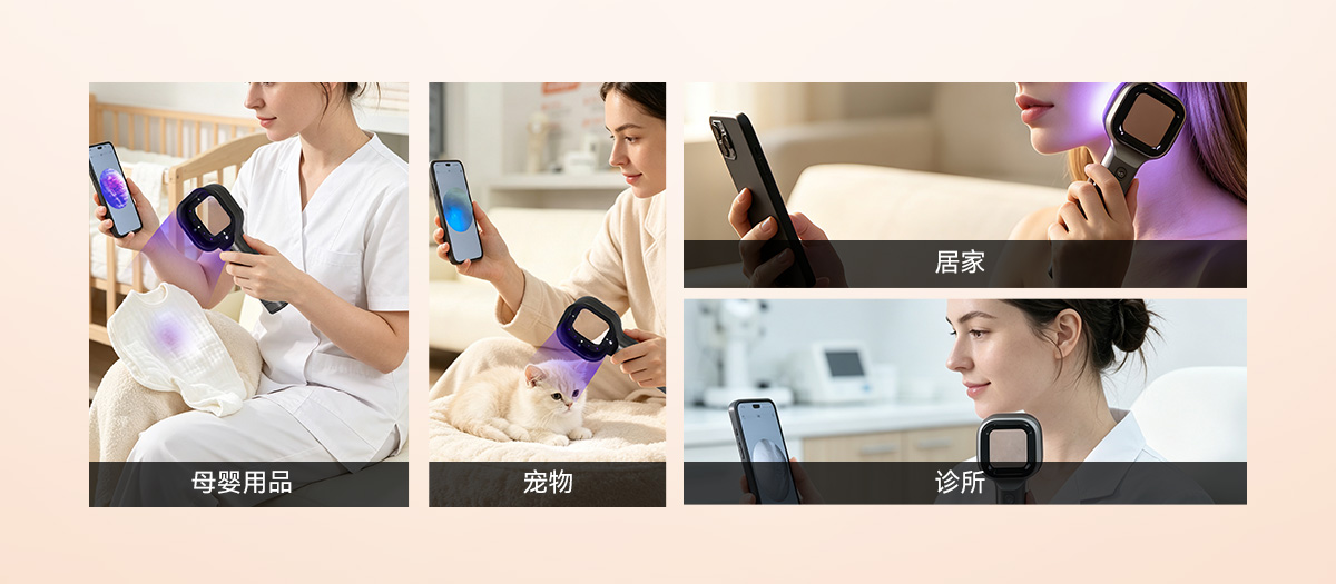 Handheld UVB therapy on leg